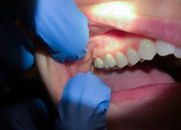 Best Emergency TMJ Treatment in Eldorado, TX